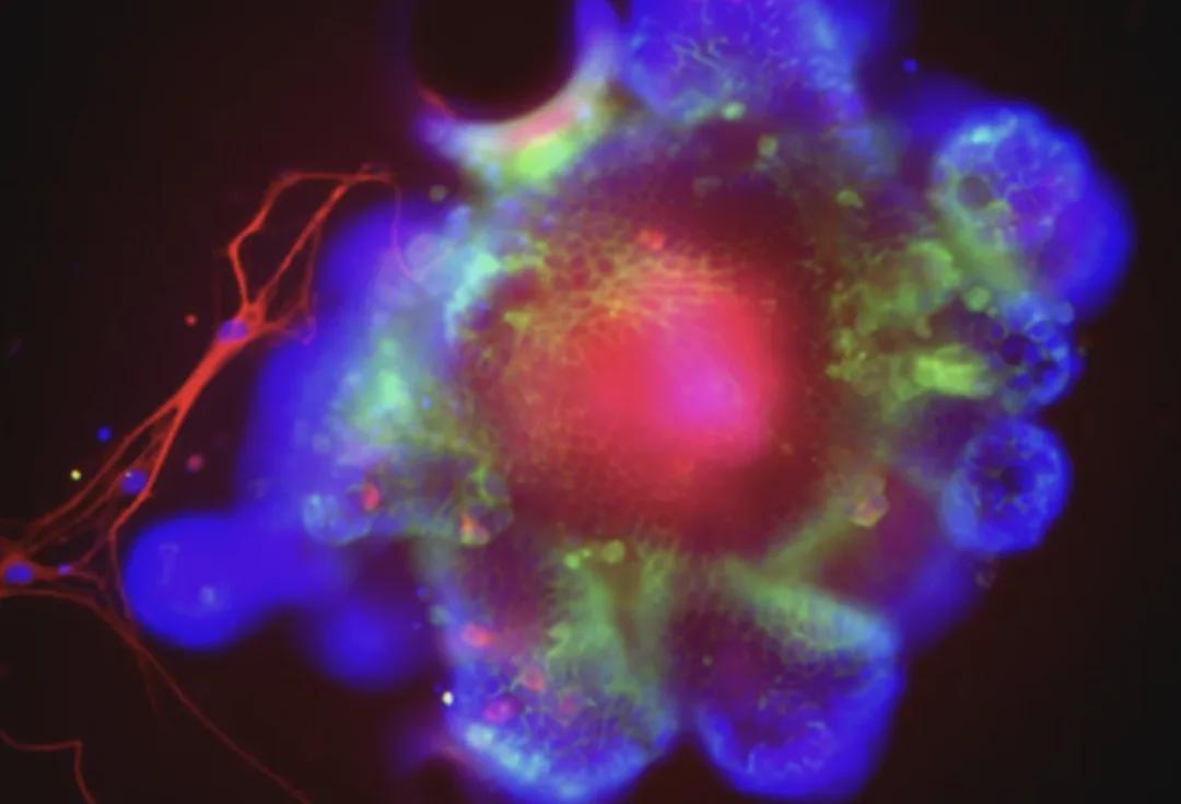 《自然》重磅！刚刚，终于发现酒精伤肝底层逻辑了，你还敢喝吗？